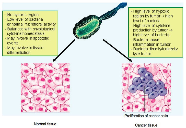 Normal tissue compared with cancerous tissue