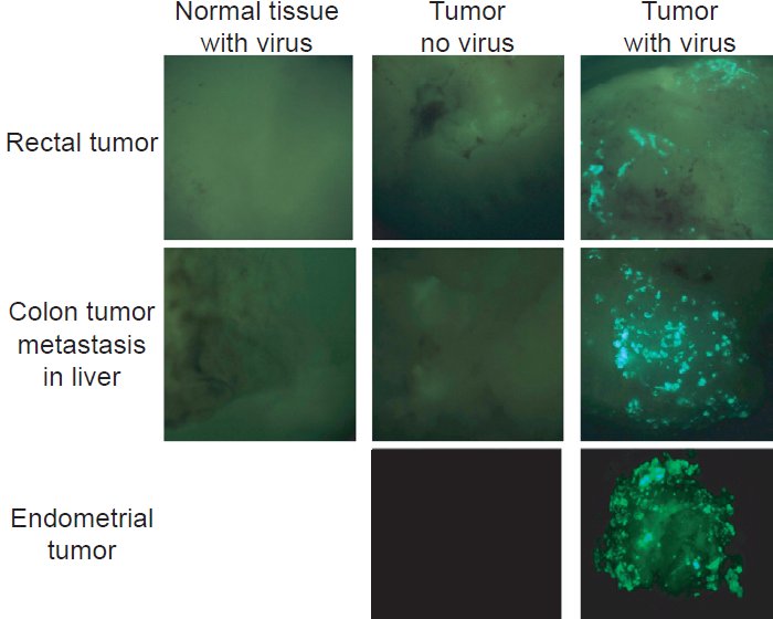 Normal tissue with viruses, tumors, and tumors with viruses