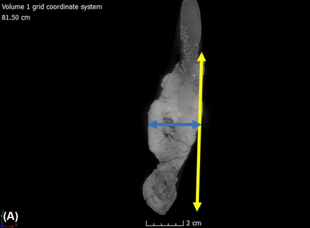 Figure 13a