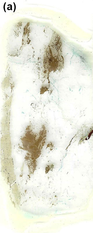 Figure 9a