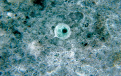 A Possible Function of Entamoeba histolytica in the Creation Model