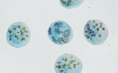 Information Processing Differences Between Bacteria and Eukarya—Implications for the Myth of Eukaryogenesis