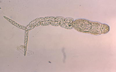 A Baraminic Study of the Blood Flukes  of Family Schistosomatidae